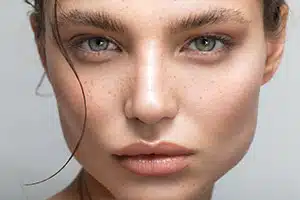 4 Procedures To Define Your Cheekbones